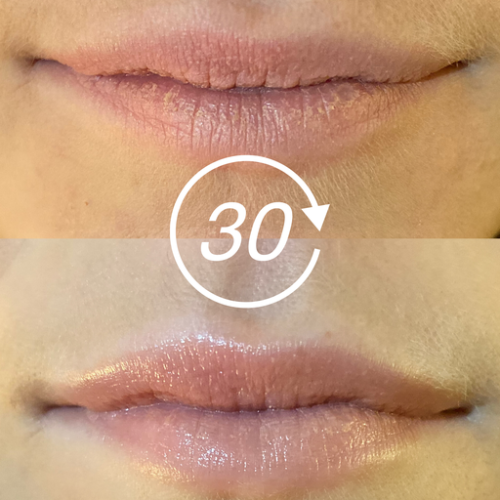 Маска Luscious Lips для губ Lip Infusion Therapy восстанавливающая LIT 4 шт